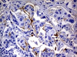Sialylated Lewis a / CA 19-9 Antibody (clone NS19)