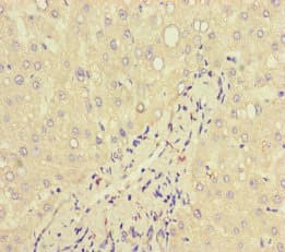 LF / LTF / Lactoferrin Antibody