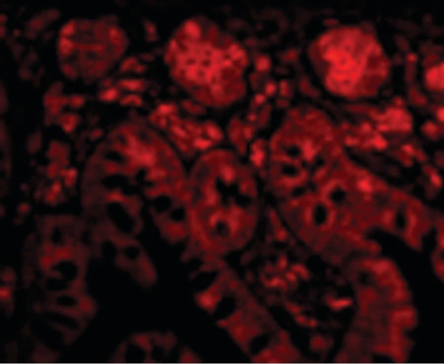 PTRH2 / BIT1 Antibody