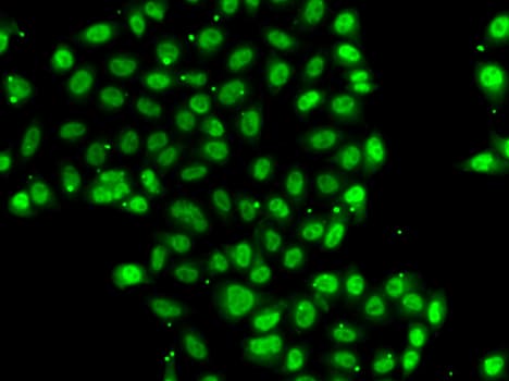 Polyclonal Rabbit anti-Human ZNF148 / ZBP-89 Antibody (IHC, IF, WB)