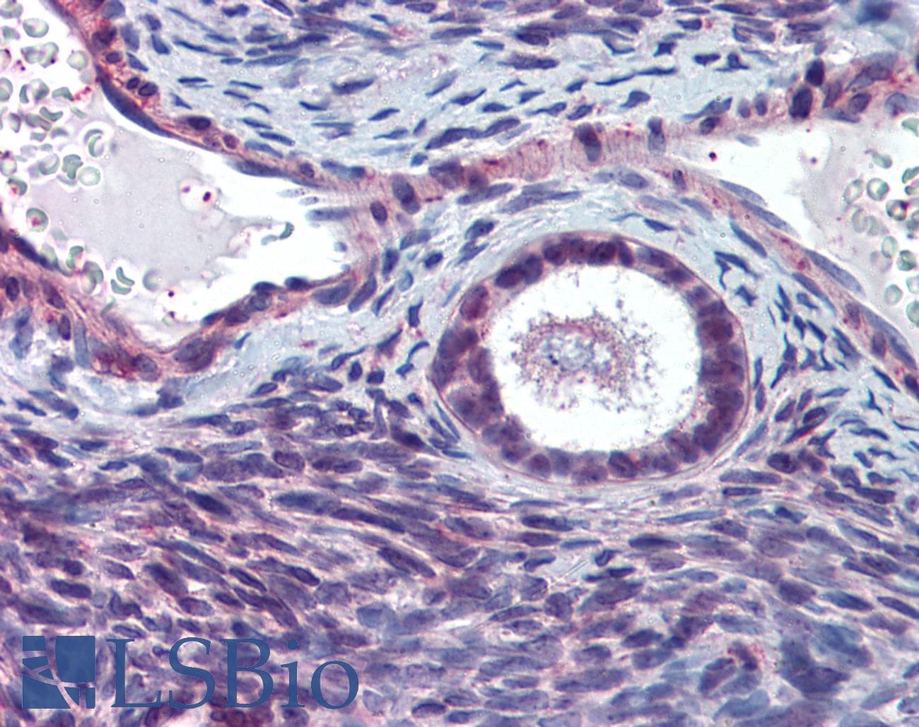 IHC-plus™ Polyclonal Rabbit anti-Human HELO1 / ELOVL5 Antibody (N-Terminus, IHC)