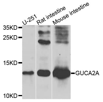 IHC-plus™ GUCA2A / Guanylin Antibody