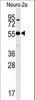 WDR18 Antibody (aa390-418)