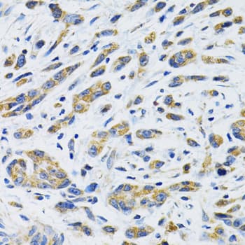 Polyclonal Rabbit anti-Human SLC16A4 Antibody (IHC, IF, WB)