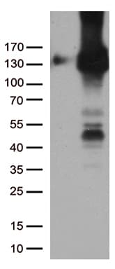 PECAM-1 / CD31 Antibody (clone UMAB32)