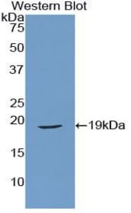 RLN1 / Relaxin Antibody (aa25-181, FITC)