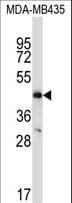 CCR9 / CD199 Antibody (aa306-334)