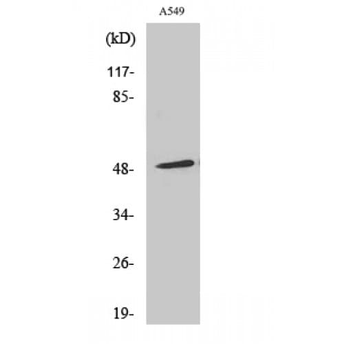 ARRB1 / Beta Arrestin 1 Antibody (350-430 aa)