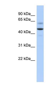 ARSA / Arylsulfatase A Antibody (C-Terminus)