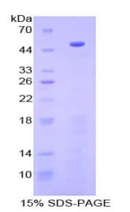 Human PCOLCE Protein (Recombinant His-T7)
