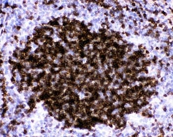 FCER2 / CD23 Antibody (aa50-331)