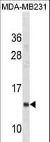 CD225 / IFITM1 Antibody (aa37-66)