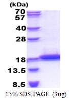 Human TCL1B Protein (Recombinant His)