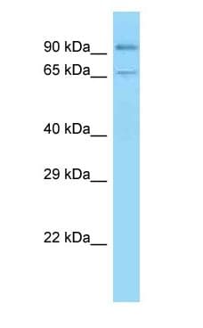 CDH1 / E Cadherin Antibody (C-Terminus)