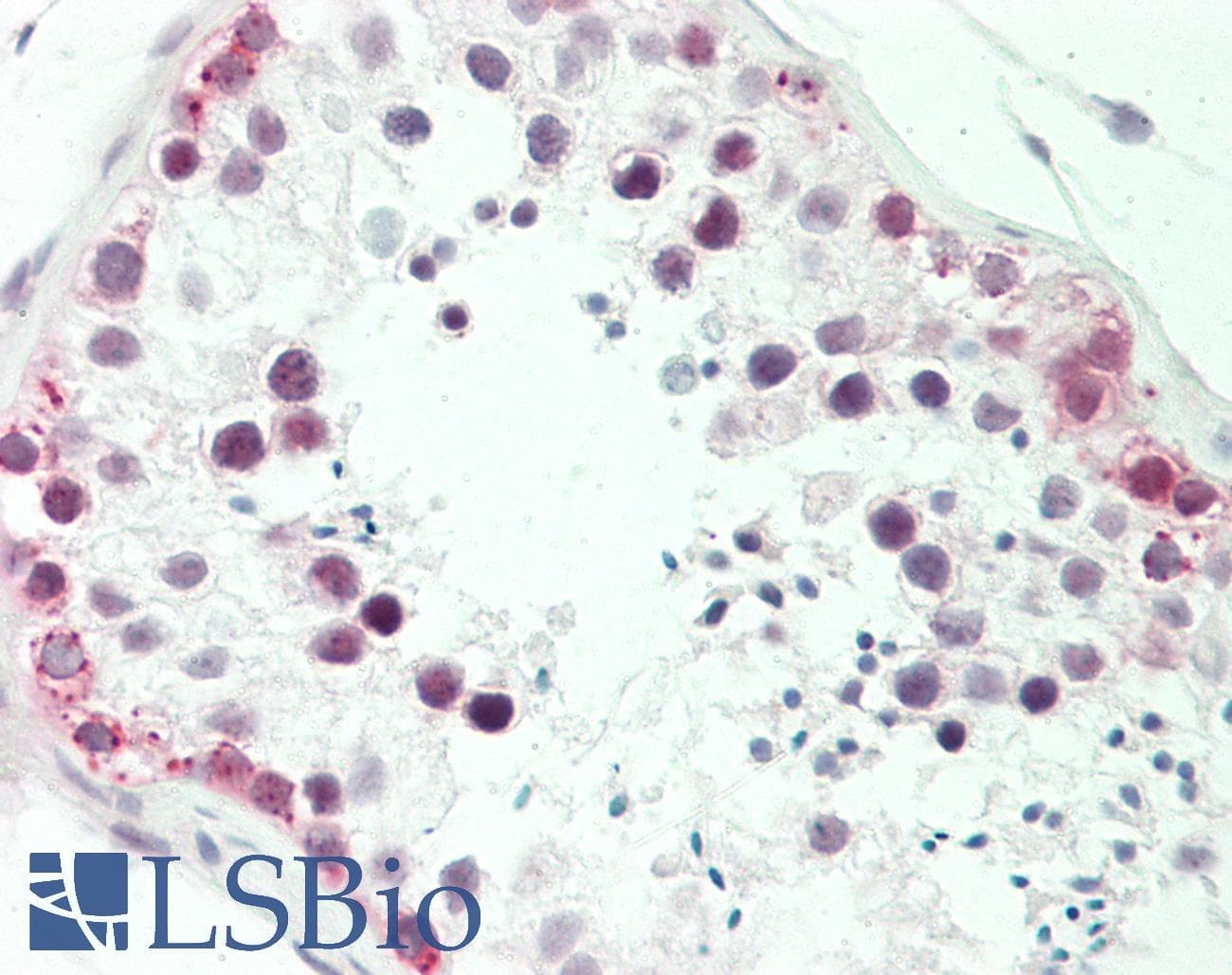 IHC-plus™ MTA1 Antibody (aa400-450)