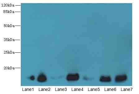 IHC-plus™ CYB5B Antibody