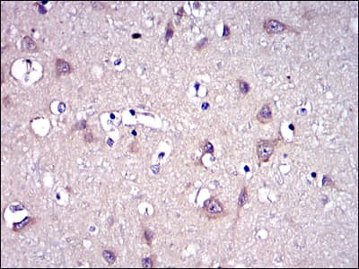 Monoclonal Mouse anti-Human MMP9 / Gelatinase B Antibody (clone 5G3, IHC, IF, WB)