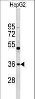 Polyclonal Rabbit anti-Human ELOVL2 Antibody (aa1-27, IHC, WB)