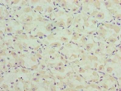 CASQ1 / Calsequestrin 1 Antibody