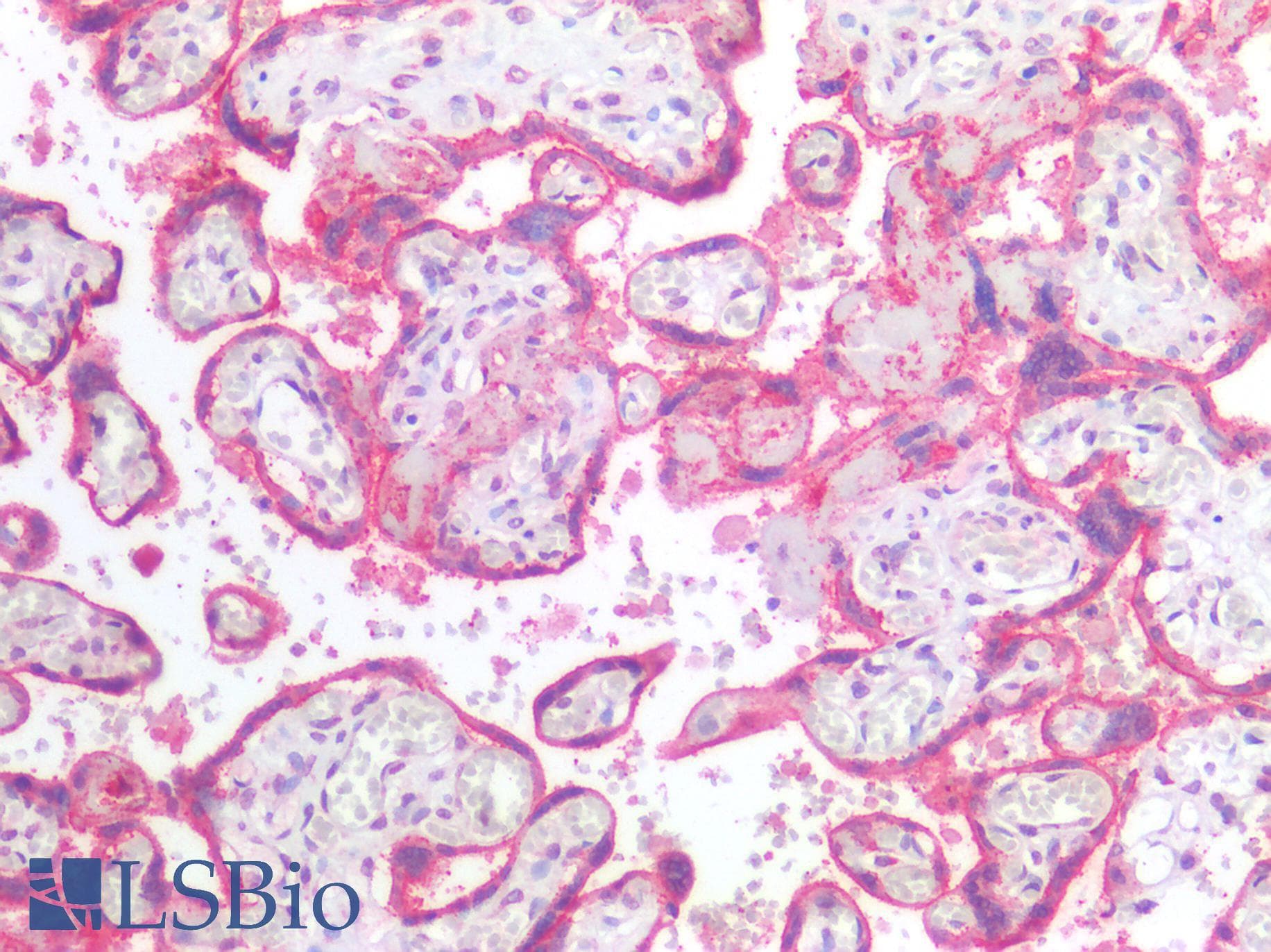 IHC-plus™ Polyclonal Rabbit anti-Human VEGFA / VEGF Antibody (IHC)