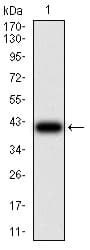 IHC-plus™ CCND1 / Cyclin D1 Antibody (clone 3B6G3)