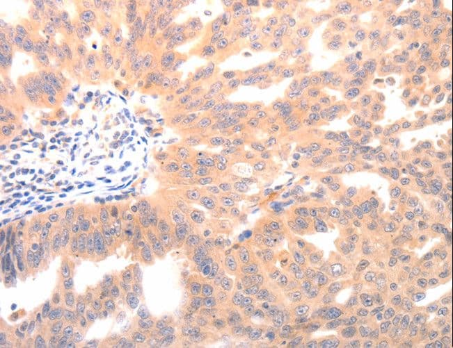 Osteocalcin Antibody