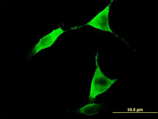 IHC-plus™ Monoclonal Mouse anti-Human ALDH1L1 Antibody (clone 3E9, IHC, IF, WB)