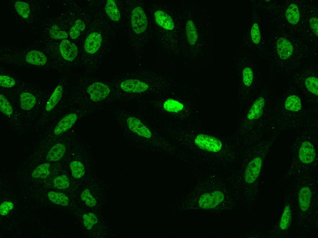 Polyclonal Rabbit anti-Human ZMYM3 Antibody (IF)