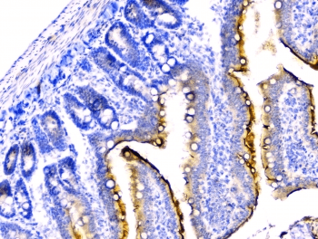 Polyclonal Rabbit anti-Mouse DDR2 Antibody (IHC, WB)