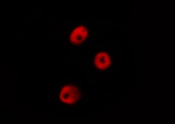 Polyclonal Rabbit anti-Human POU5F1 / OCT4 Antibody (IHC, IF, WB)