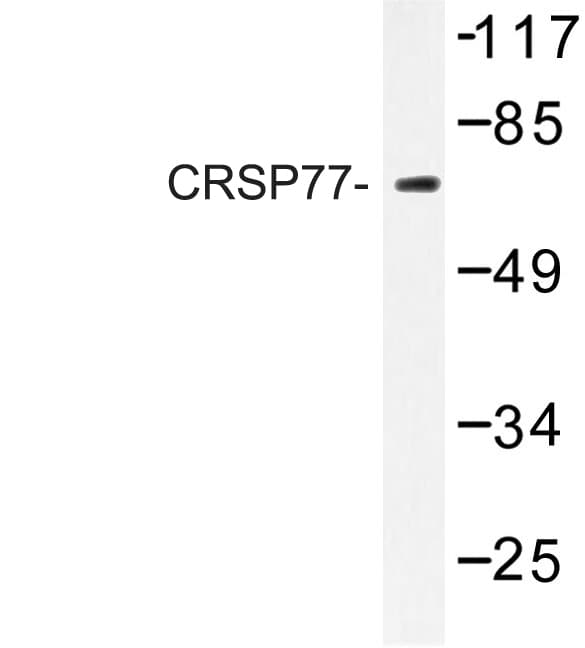 MED17 / TRAP80 Antibody (Val171)