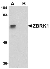 Polyclonal Rabbit anti-Human ZNF350 Antibody (WB)