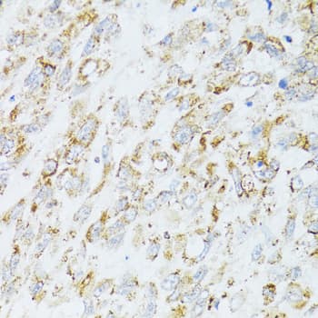 Polyclonal Rabbit anti-Human EGFR Antibody (IHC, IF, WB)