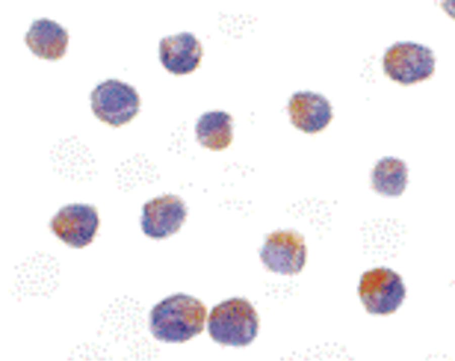 IHC-plus™ STK17B / DRAK2 Antibody