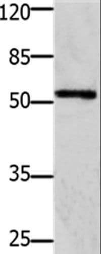 Polyclonal Rabbit anti-Human GFRA1 / GFR Alpha Antibody (WB)