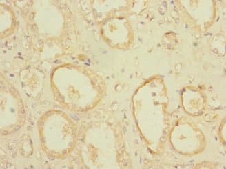 Polyclonal Rabbit anti-Human POGK Antibody
