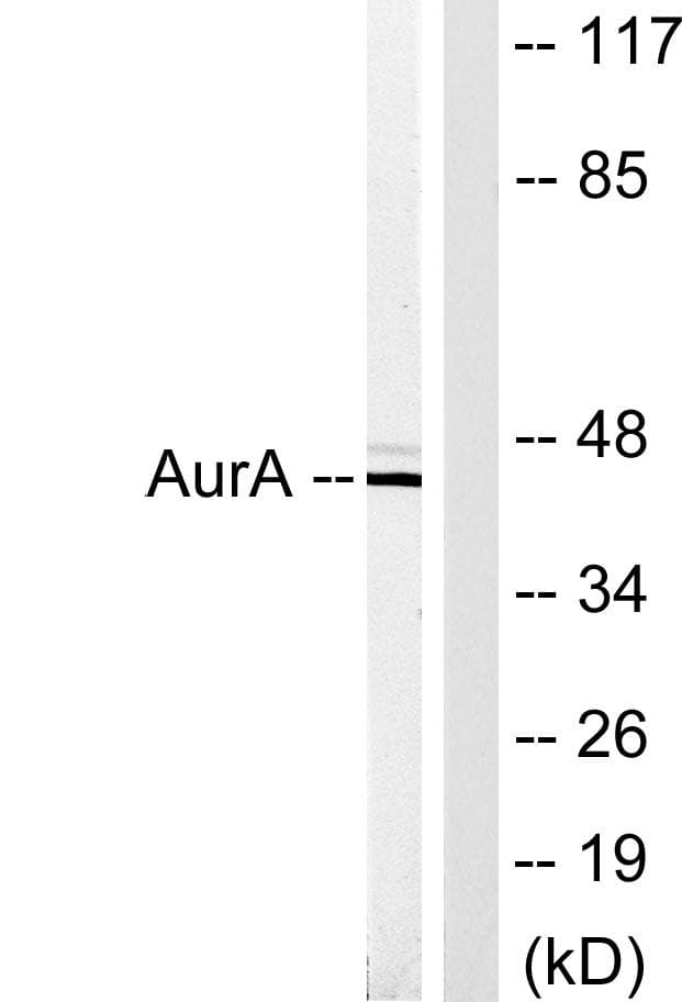 AURKA / Aurora-A Antibody (p342)