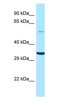 Polyclonal Rabbit anti-Human GPS1 / CSN1 Antibody (aa82-131, WB)