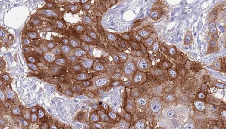 SELPLG / PSGL-1 / CD162 Antibody