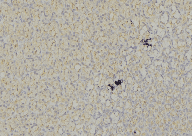 CD135 / FLT3 Antibody