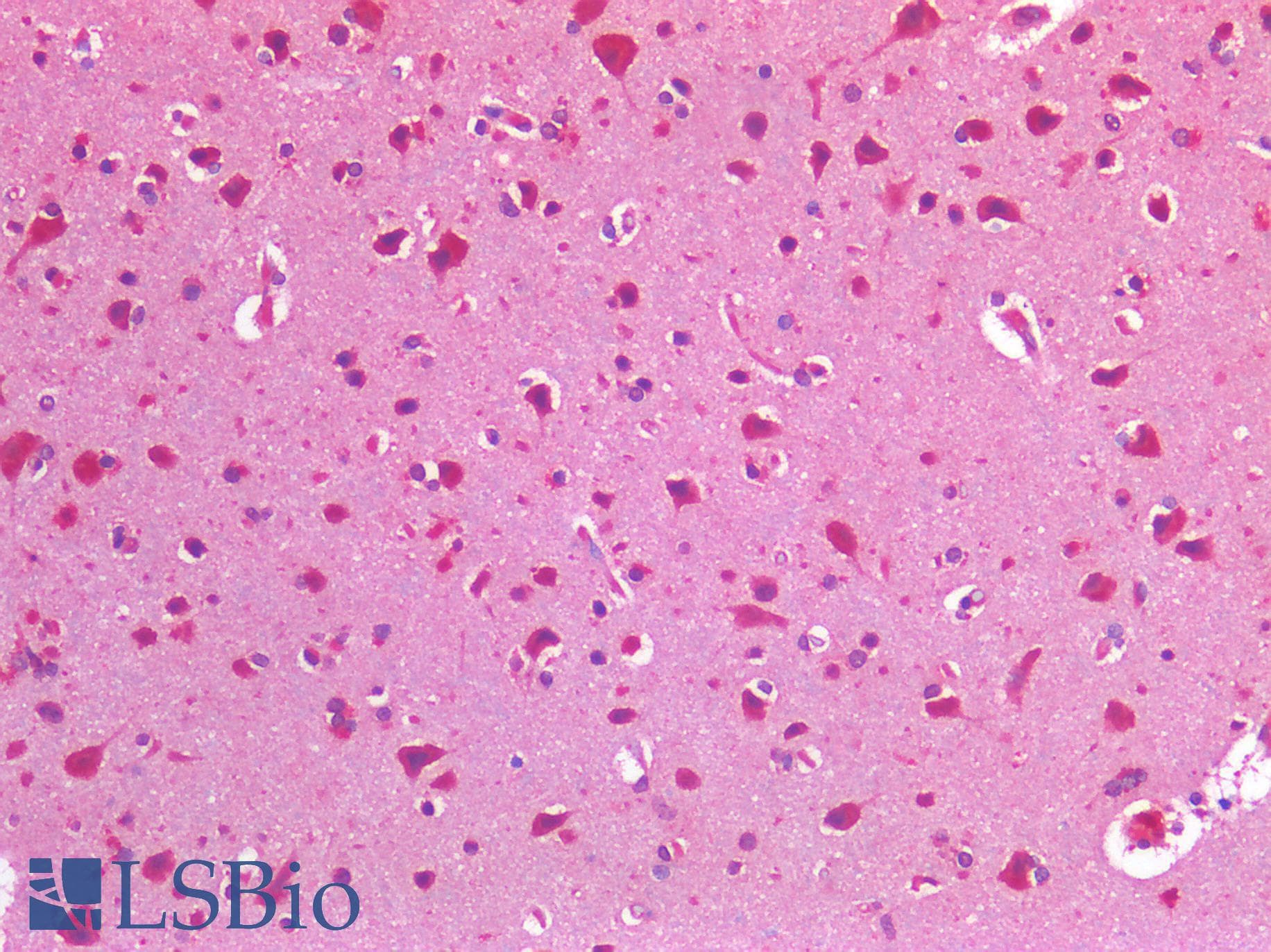 IHC-plus™ IGF1R / IGF1 Receptor Antibody