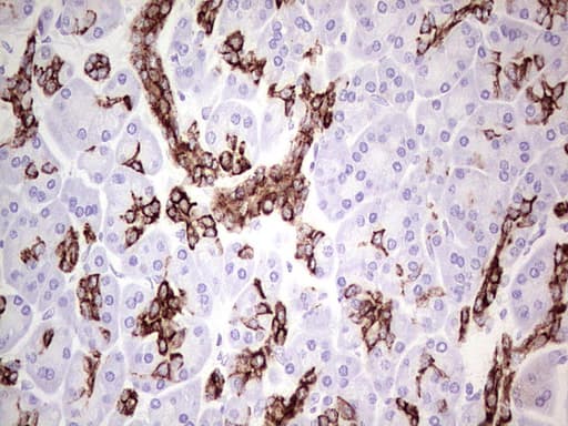 KRT19 / CK19 / Cytokeratin 19 Antibody (aa240-390, clone UMAB186)