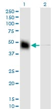 KRT18 / CK18 / Cytokeratin 18 Antibody (clone 2F8)