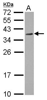 RPRD1A Antibody