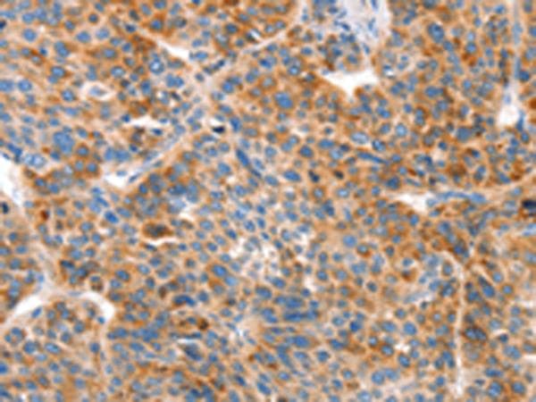 VTN / Vitronectin Antibody
