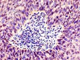 SMARCD1 / BAF60A Antibody