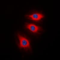 Polyclonal Rabbit anti-Human CALD1 / Caldesmon Antibody (C-Terminus, IHC, IF, WB)