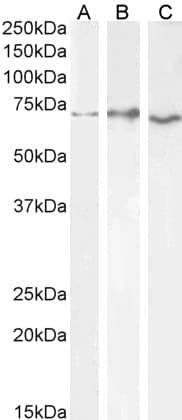 Polyclonal Goat anti-Human ACHE / Acetylcholinesterase Antibody (aa601-614, IF, WB)