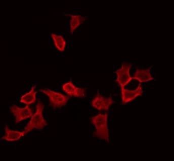 RAB11B Antibody