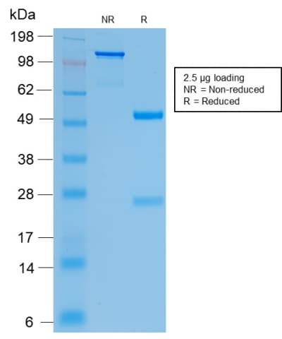 Recombinant Monoclonal Rabbit anti-Human CFTR Antibody (clone CFTR/2290R, IHC)